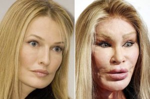 Foto da Jocelyn Wildenstein