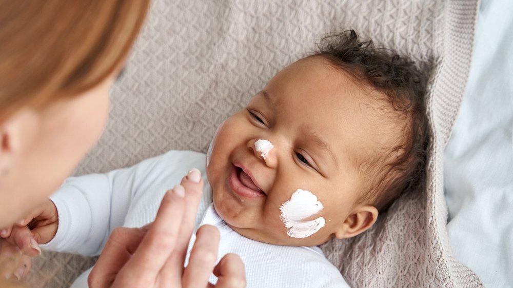 Bebê sorrindo com pomada na bochecha e nariz