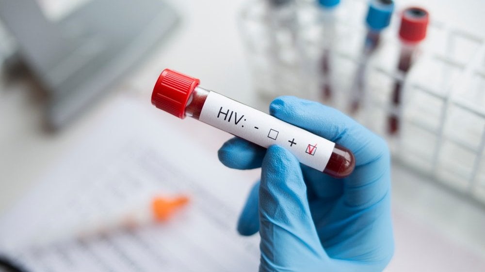 mão segurando teste de HIV